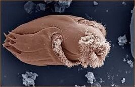 Pathogene micro -organismen bij mensen