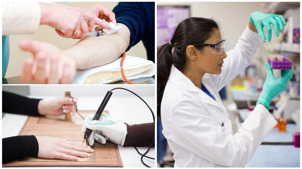 Diagnostische methoden om parasieten in het lichaam te detecteren