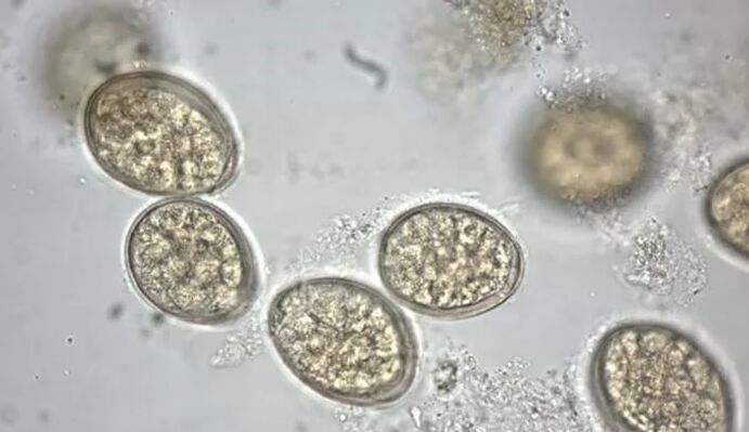 parasieten onder een microscoop