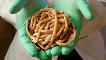 Methoden voor eliminatie van parasieten uit het lichaam