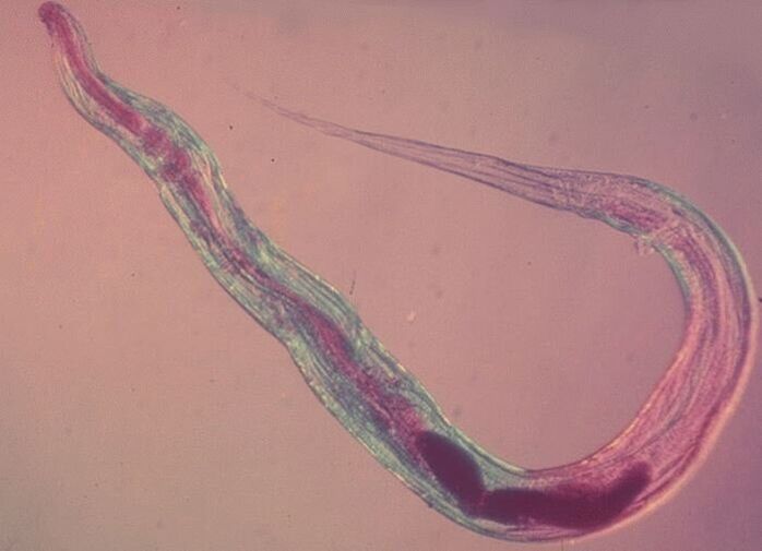 Pinworm onder een microscoop