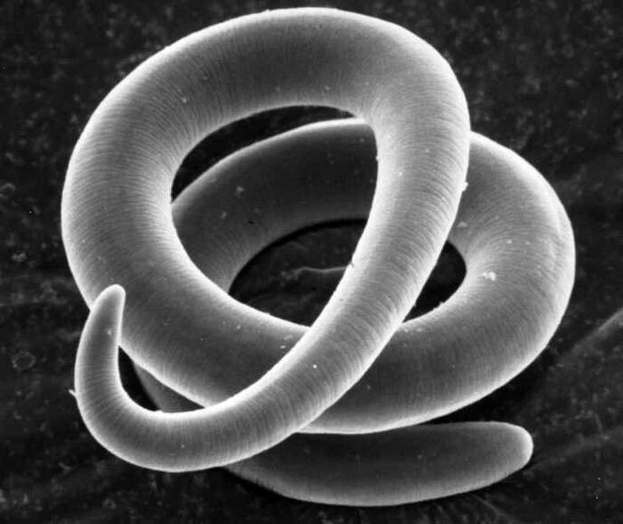 Trichinella onder een microscoop