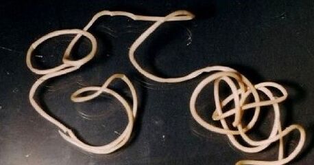Guinea worm